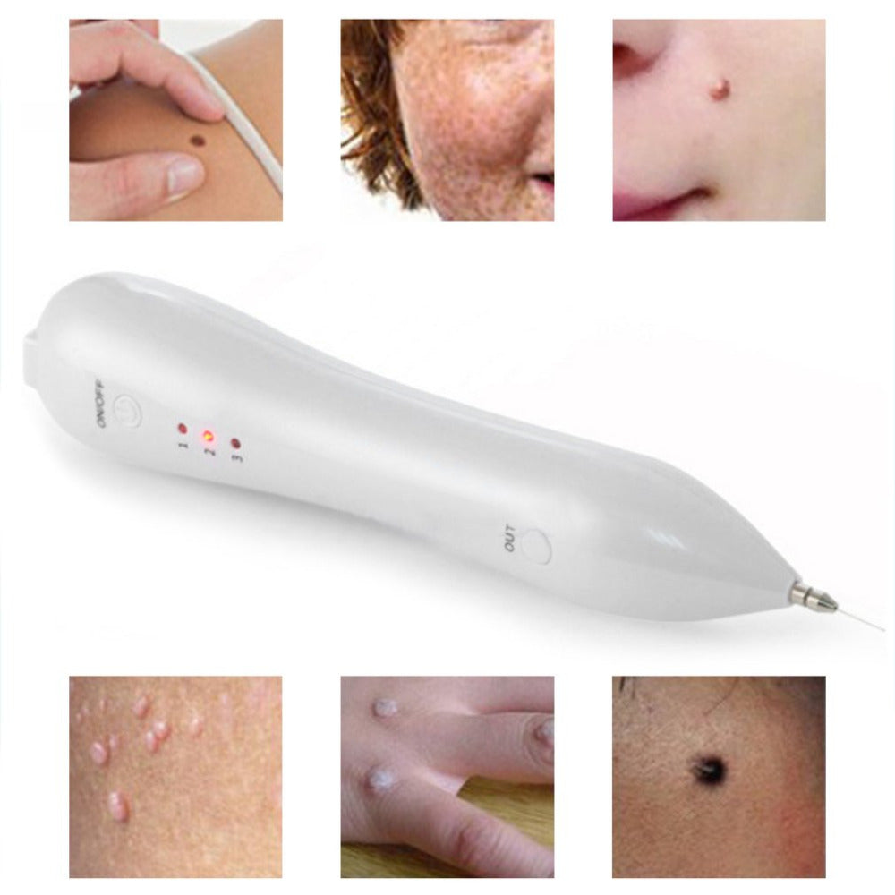 Beauty pen latest freckle removal technology