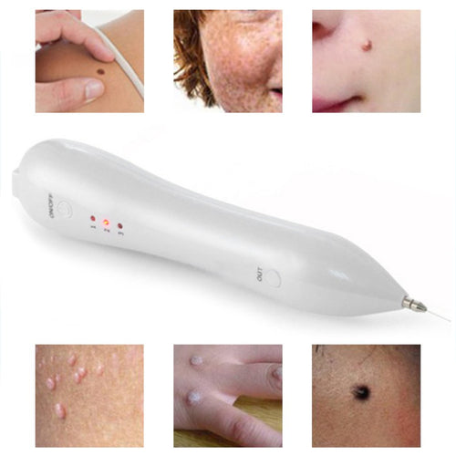Beauty pen latest freckle removal technology